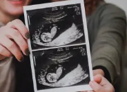 Life after delivery ultrasounds